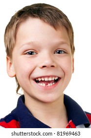 Funny Happy Child Without One Tooth Stock Photo 81969463 | Shutterstock