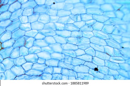 Fuzzy Plant Cells Seen Under A Microscope