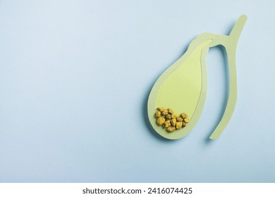 Gallbladder decorative model with gallstones on pastel blue background. Gallbladder disease concept. Top view, copy space