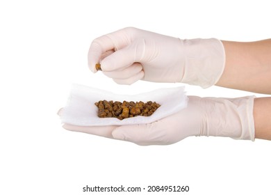 Gallbladder stones in the hands of a doctor after cholecystectomy isolated on white background