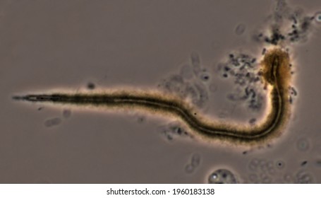 Gallionella, Microscope Image Of Filament Of Iron-bacterium (phase Contrast Microscopy)