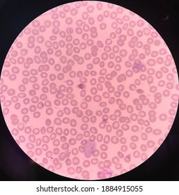 Gametocyte Ring Form Plasmodium Knowlesi Stock Photo 1884915055 ...