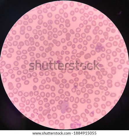 Gametocyte and ring form of Plasmodium knowlesi