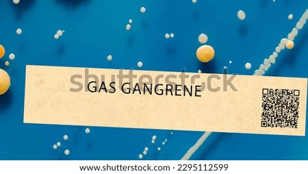 Gas gangrene - Bacterial infection that can cause tissue death and gas production in wounds.