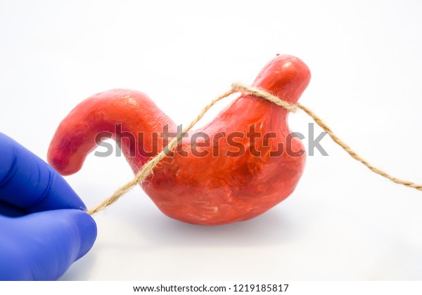 Gastric or stomach banding surgery for weight\
loss or treatment of diaphragmatic hernia concept photo. Doctor\
pinched anatomical model of stomach using rope, preventing flow of\
food, showing procedure