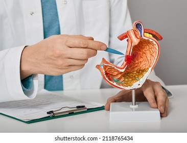Gastroenterologist consultation, treatment of stomach diseases and ulcers. Doctor pointing to gastric ulcer on anatomical model of stomach - Shutterstock ID 2118765434