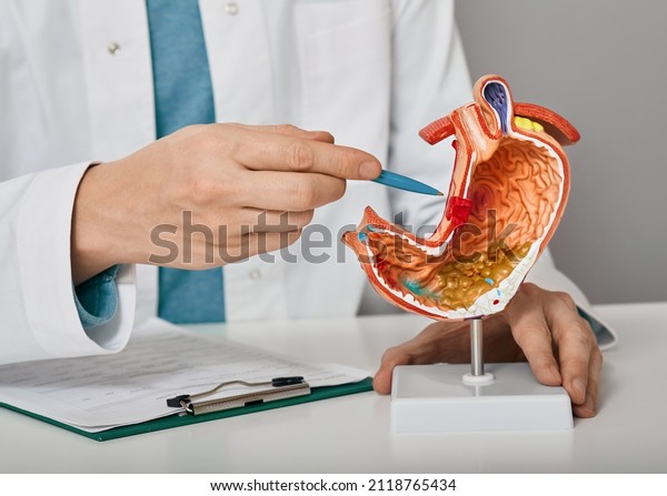Gastroenterologist consultation, treatment of\
stomach diseases and ulcers. Doctor pointing to gastric ulcer on\
anatomical model of\
stomach