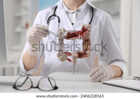 Gastroenterologist showing anatomical model of large intestine at table in clinic, closeup