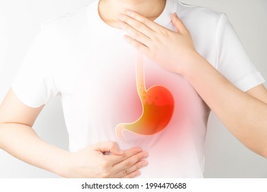 Gastroesophageal Reflux Disease (GERD) Or Acid Reflux Symptoms. Woman Suffering From Heartburn, Stomachache, Nausea And Bloating. Gastrointestinal System Disease And Digestive Problems.