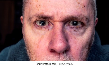 Gaunt Middle Aged Man With Tears In His Eyes, Grief, Depression And Loss Concept.