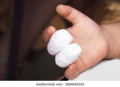 Gauze Bandages On Fingers. Accidental Wound Injury Things To Watch Out For Small Children.