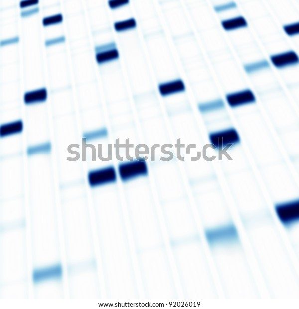 Gel Electrophoresis Method Used Clinical Chemistry Stock Photo Edit Now 92026019