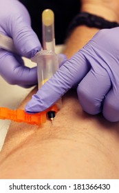 Genuine Photos Of A Phlebotomist Aka Nurse, Doctor, Or Trained Medical Professional Taking Real Blood Samples For Analysis From A Patient. Photos Taken By The Patient While Its Happening.  