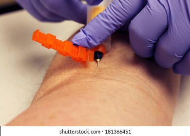 Genuine Photos Of A Phlebotomist Aka Nurse, Doctor, Or Trained Medical Professional Taking Real Blood Samples For Analysis From A Patient. Photos Taken By The Patient While Its Happening.  