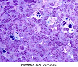 Germinal Centre Of A Lymph Node Follicle Showing Centroblasts, Mitosis, Large Clear Macrophages With Phagocyted Cell Debris. 0.5 Micrometre Thick Section Stained With Toluidine Blue.