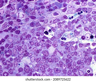 Germinal Centre Of A Lymph Node Follicle Showing Centroblasts, Mitosis, Large Clear Macrophages With Phagocyted Cell Debris. 0.5 Micrometre Thick Section Stained With Toluidine Blue.