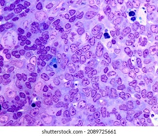 Germinal Centre Of A Lymph Node Follicle Showing Centroblasts (some In Mitosis), Large Clear Macrophages With Phagocyted Cell Debris. 0.5 Micrometre Thick Section Stained With Toluidine Blue