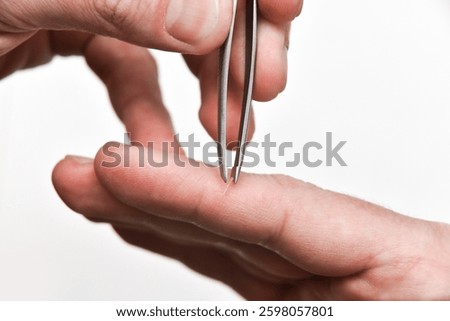 Getting a splinter from a finger, close up view