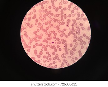 148 Giant Platelets Images, Stock Photos & Vectors | Shutterstock