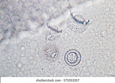 Gills Fish Protozoa Trichodina Spp Under Stock Photo 575353357 ...