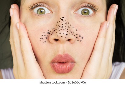 Girl With Acne On Her Nose