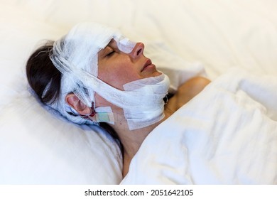 A Girl After Surgery With A Bandaged Head Lies On The Bed. Head Trauma, Concussion, Injured In A Car Catastrophe