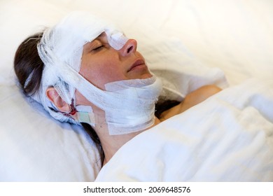 A Girl After Surgery With A Bandaged Head Lies On The Bed. Head Trauma, Concussion, Injured In A Car Catastrophe