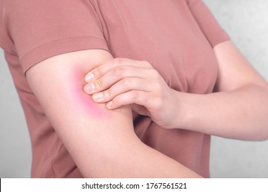 The Girl With The Arm Of A Sick Bicep  The Pain In My Arm. Sore Biceps. A Shot In The Arm. Arthritis, Arthrosis, Inflammation In The Muscle. Stretching Of The Muscles

