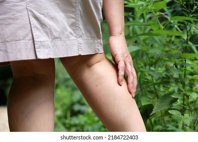 Girl With Bare Legs Holding On To The Shin Standing On A Path Near Tall Stinging Nettle. Leisure In Countryside In Summer, Danger For Skin