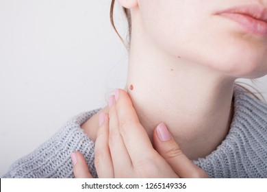 Girl with birthmarks on the neck - Shutterstock ID 1265149336