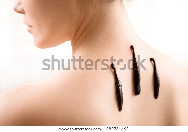 The girl with bloodsuckers on a back on a\
white background.