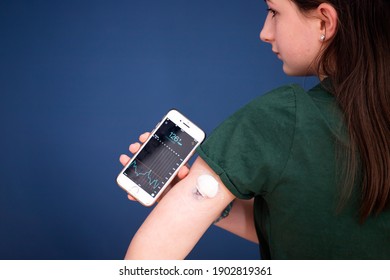 Girl Checking Glucose Level With A Remote Sensor And Mobile Phone. Continuous Glucose Monitor.