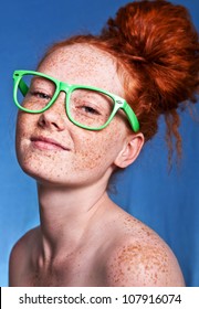 Girl Covered With Freckles