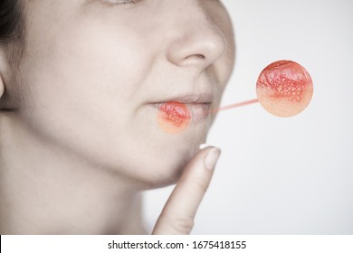 帯状疱疹 の画像 写真素材 ベクター画像 Shutterstock