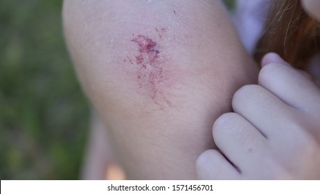 Free Gambar Girls Hand Cut Blood Images Stock Photos Vectors Terbaru oleh www.katacinta.co