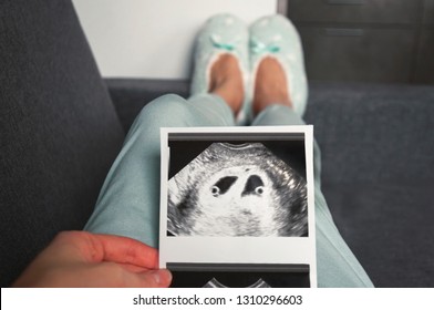 The Girl Is Holding A Snapshot Of An Ultrasound Twin In The Fourth Week Of Pregnancy. First Trimester. Selective Focus