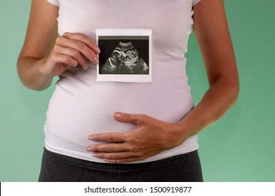 The Girl Is Holding A Snapshot Of An Ultrasound Twin In The Fourth Week Of Pregnancy. First Trimester. Confirmation Of Pregnancy