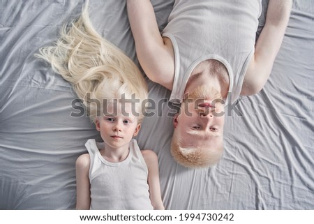 Girl laying at the grey blanket with her albino father while spending time at home