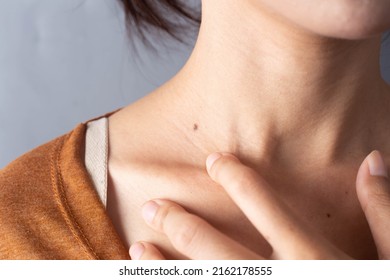 girl with a mole on her neck