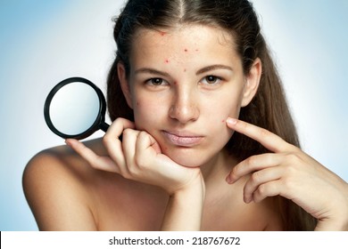 Girl with a pimply face holding magnifying glass. Woman skin care concept / photos of Latina girl on blue background