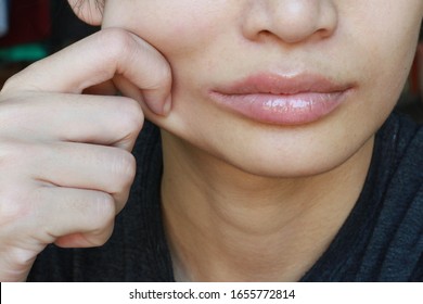  A Girl Pulling Her Cheek Showing Softness