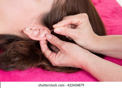 Girl receiving facial acupuncture treatment on ear