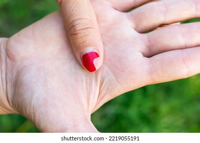 The Girl Shows A Bad Old Manicure. Overgrown Nail Polish, Broken Nail. Manicure Correction, Old Manicure. Nail Care, It's Time To Go To The Salon.