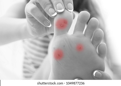 girl shows doctor foot of foot and with problem areas on skin,