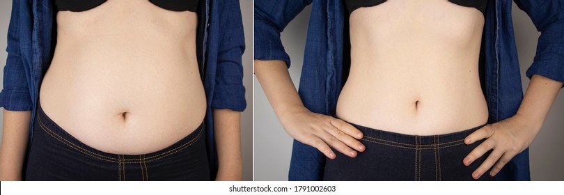 Das Mädchen zeigt die Ergebnisse der Arbeit am Körper. Vor und nach einer dicken und dünnen Taille. Auf dem Foto links ist Bauchfett sichtbar. Auf dem Foto rechts eine dünne Taille ohne zusätzliche Kilogramm