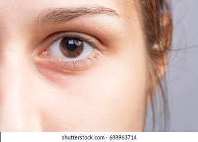 Girl with soft skin in the face before cosmetic treatment