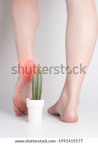 The girl steps on the cactus with her foot. The concept of pain in the sole and heel, metabolic disorders, cracked skin on the heels