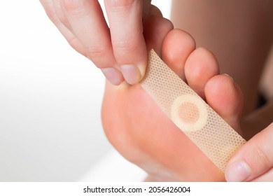 A Girl Sticks A Medical Plaster For Plantar Warts On Her Leg. Callus Treatment. Copy Space For Text, Discomfort