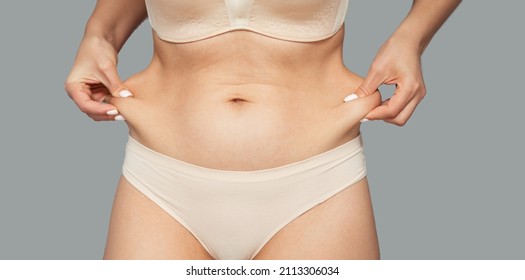 The Girl Tightens The Skin On Her Stomach, Showing Fat Deposits In The Abdomen And Sides. Treatment And Getting Rid Of Excess Weight, Deposition Of Subcutaneous Fat.