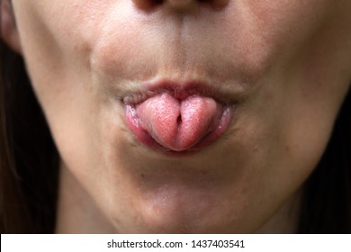 Girl who folds her u-shaped tongue, a genetically inherited trait